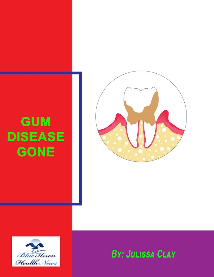 Gum Disease Gone
